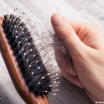 Hair Loss Causes – Taking Common Hair Diseases Seriously