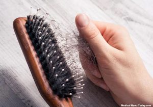 Hair Loss Causes - Taking Common Hair Diseases Seriously