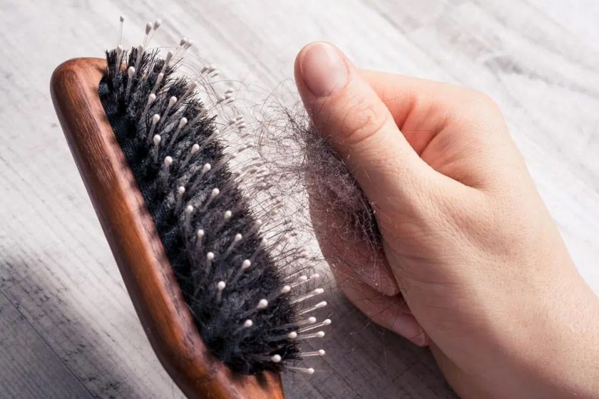 Hair Loss Causes – Taking Common Hair Diseases Seriously