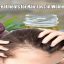 All-natural Treatments for Hair Loss in Women