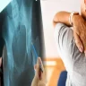 Early Signs of Osteoporosis in Women Over 40